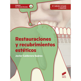 RESTAURACIONES Y RECUBRIMIENTOS ESTETICOS  JEYJO