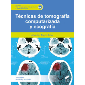 TECNICA DE TOMOGRAFIA COMPUTARIZADA Y ECOGRAFIA 3A EDICION REVISADA  JEYJO